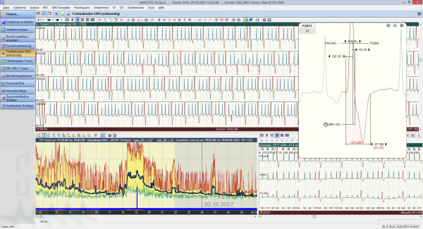 Set AMEDTEC ECGpro Holter EP8-A 830 Net